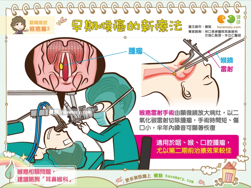 喉癌,喉癌治療,喉癌雷射,健康圖文,健康漫畫,漫漫健康,Laryngeal cancer,健談,健談網,havemary