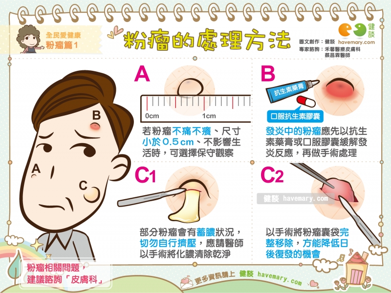 58+ 粉 瘤 画像 21 粉瘤的處理方法|全民愛健康粉瘤篇1 | 健談havemary.com - 圖解健康生活大小事