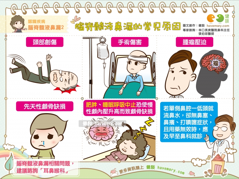 腦脊髓液鼻漏的常見原因 認識疾病腦脊髓液鼻漏2 健談havemary Com 圖解健康生活大小事