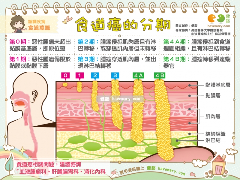 食道癌,食道癌分期,癌症,惡性腫瘤,健康圖文,健康漫畫,漫漫健康,圖解健康,蘇裕傑,蘇裕傑醫師,Esophageal cancer, esophageal cancer staging, cancer,健談,健談網,havemary 