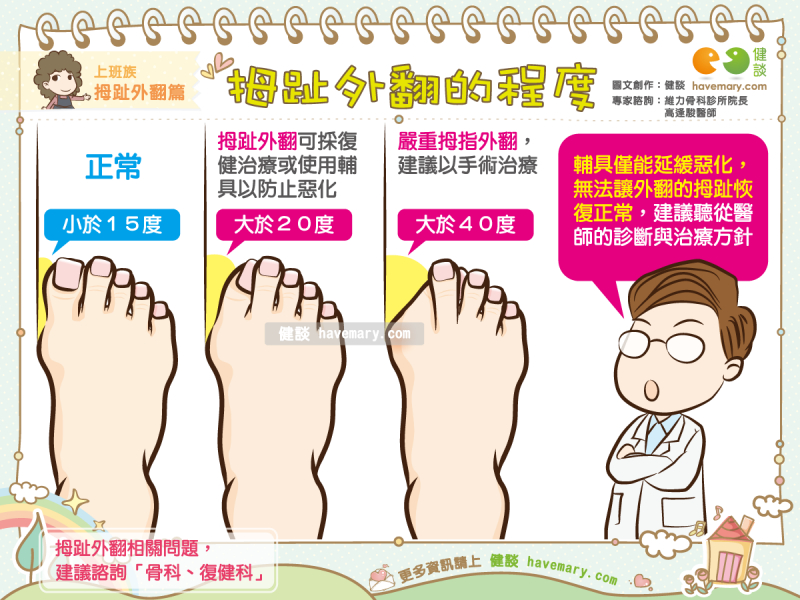 拇趾外翻的程度 健談havemary Com 圖解健康生活大小事